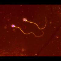 Spermatozoa, Vasin KS own work, Wikimedia commons